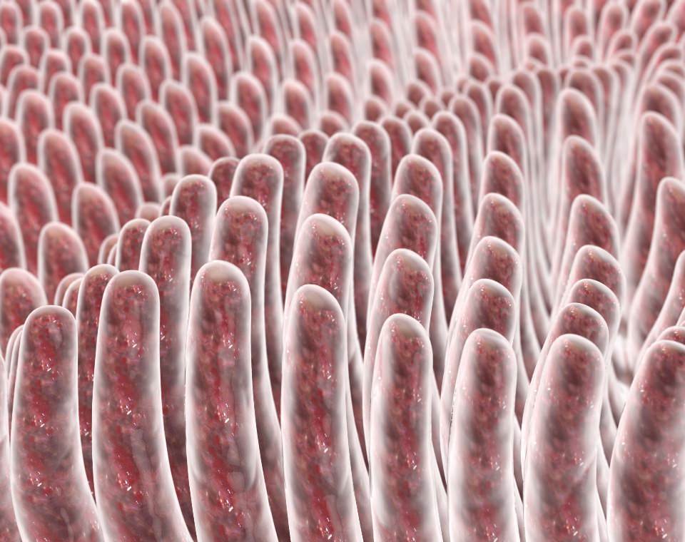 Lactose intolerance is the most common carbohydrate malabsorption