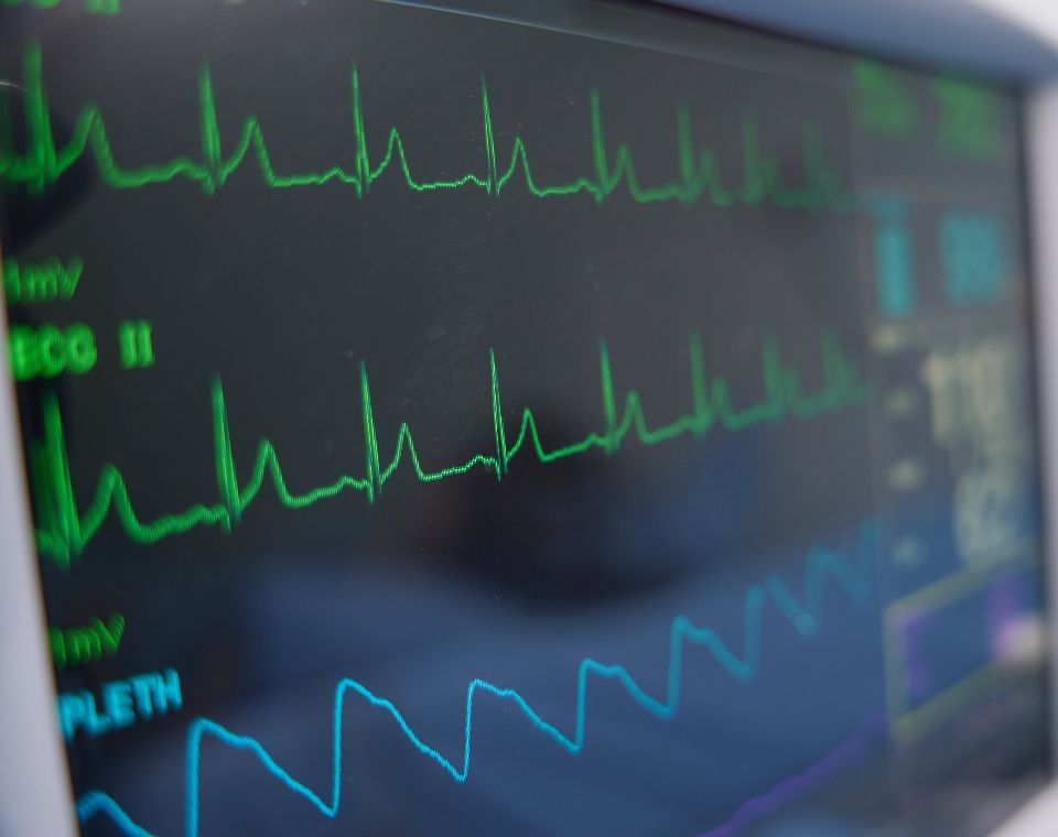 ECG block 1