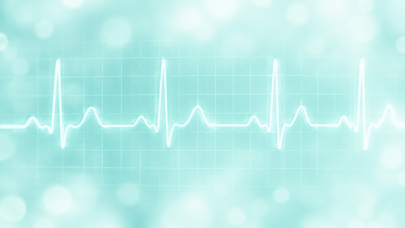 Preparing for your ECG (electrocardiogram)